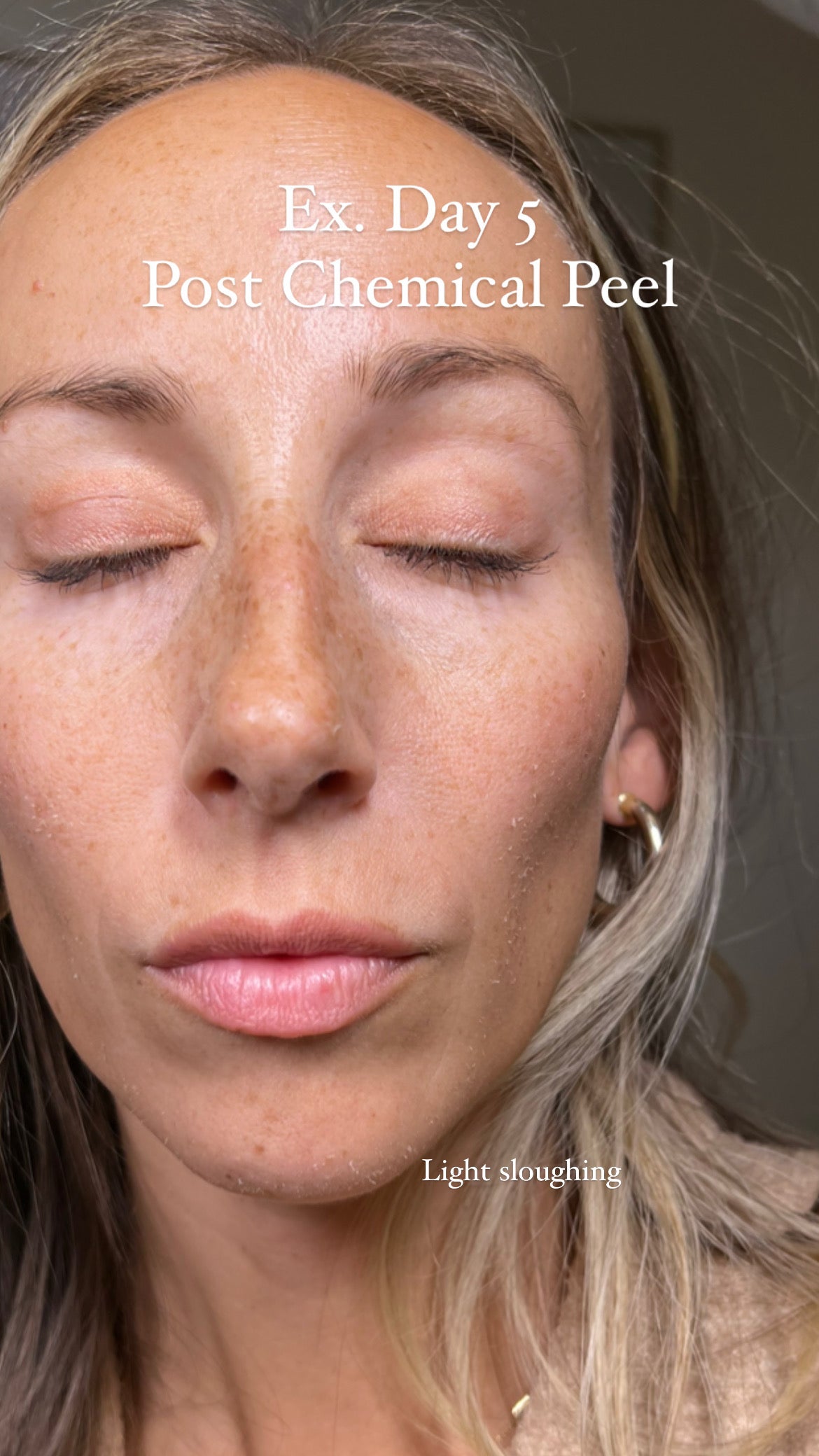 New Season New Skin Care