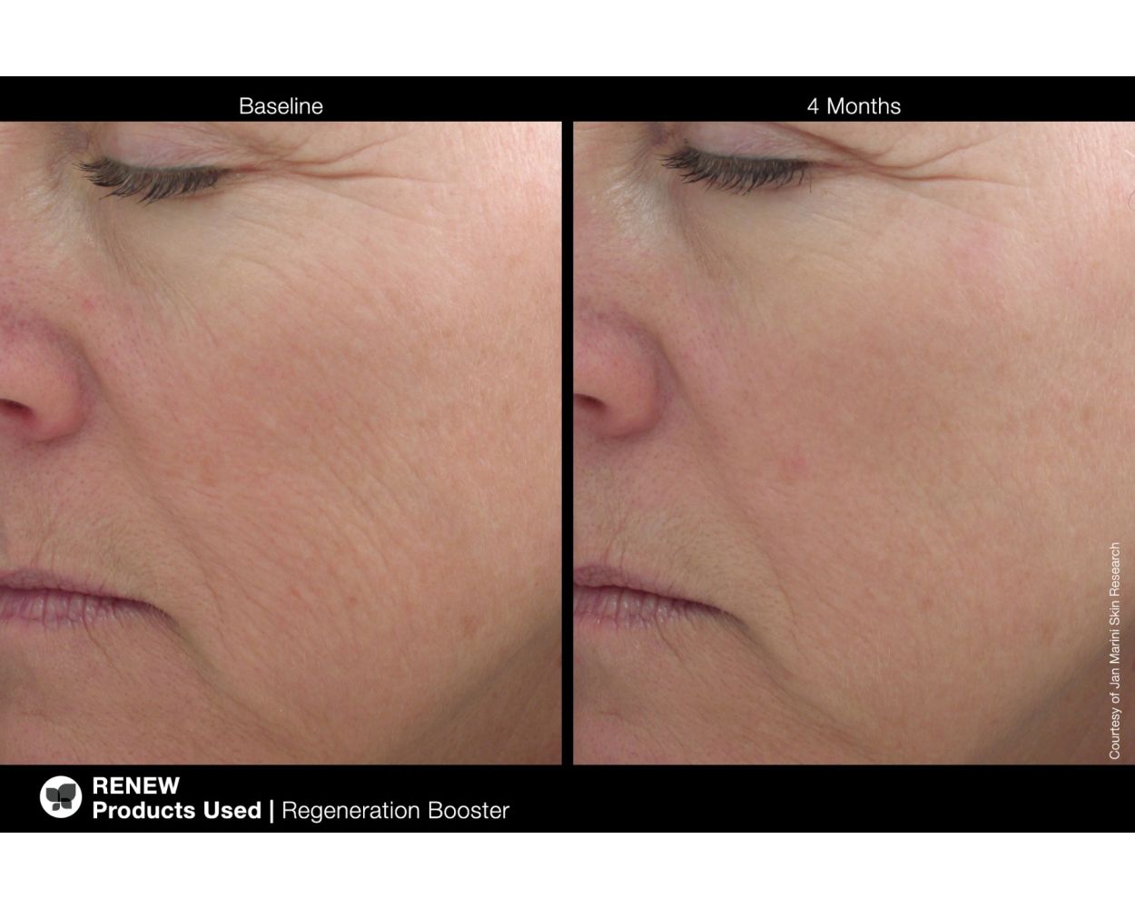 
                  
                    Jan Marini Regeneration Booster
                  
                
